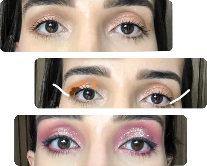 Olhos de aluna antes e depois da correção