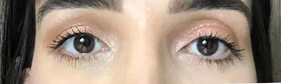 Antes: olhos parecendo assimétricos