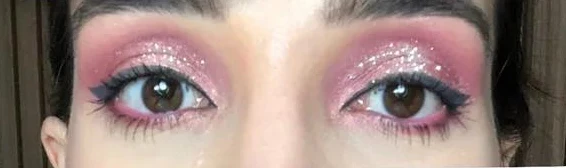 Depois: olhos equilibrados